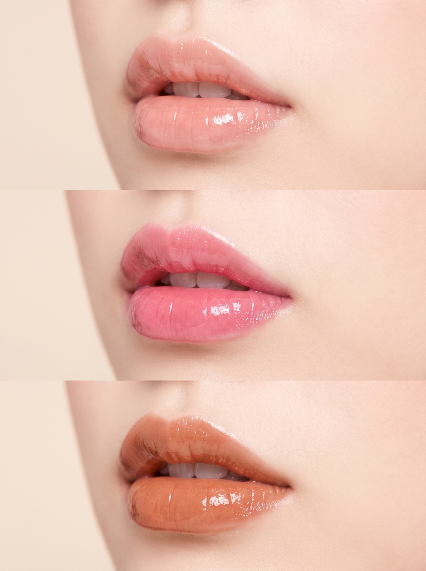 윤○○ 후기 Before